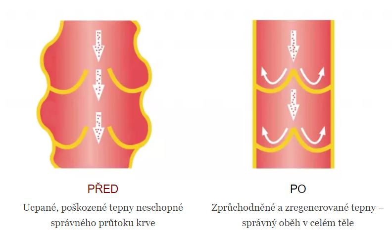 Před a po Remi Bloston