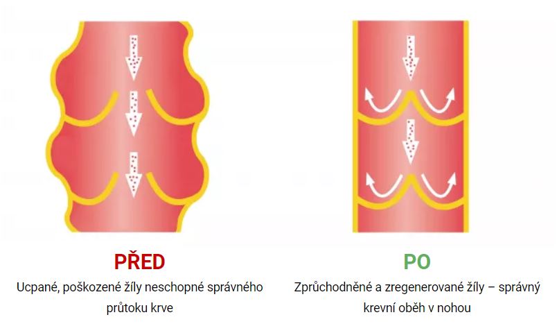 Solvenin před a po